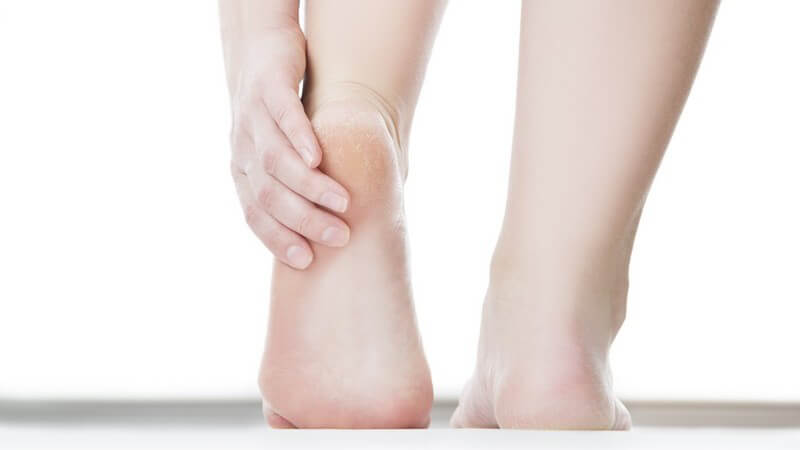 Unterschenkel und Füße einer Frau vor weißem Hintergrund, Hand fasst unter die linke Ferse