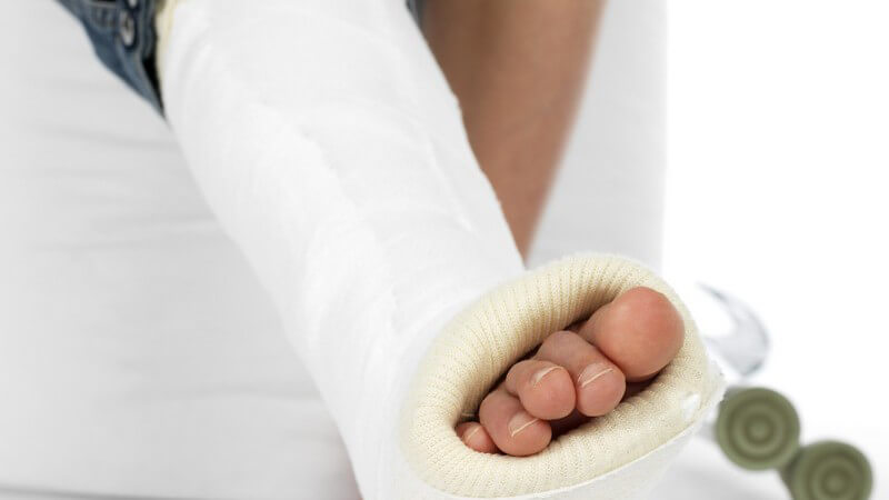 Beine eines Kindes, rechter Fuß und Unterschenkel in Gips