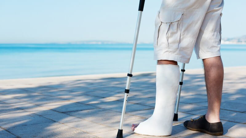 Mann mit Gipsbein am Meer, Beinbruch im Urlaub, Auslands-Krankenversicherung