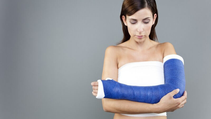 Frau mit gebrochenem Arm, Gips mit blauem Verband
