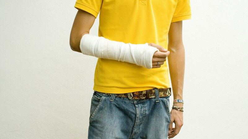Männerkörper, Arm in Gips