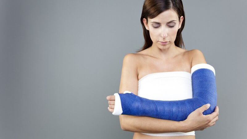Frau mit gebrochenem Arm, Gips mit blauem Verband.