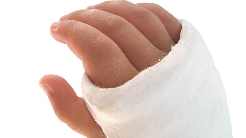 Nahaufnahme rechte Hand im Gips, weißer Hintergrund