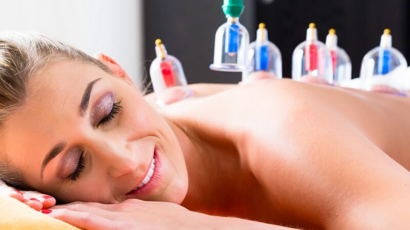 Frau liegt während Schröpfbehandlung auf dem Bauch, blaue und rote Schröpfgläser auf dem Rücken