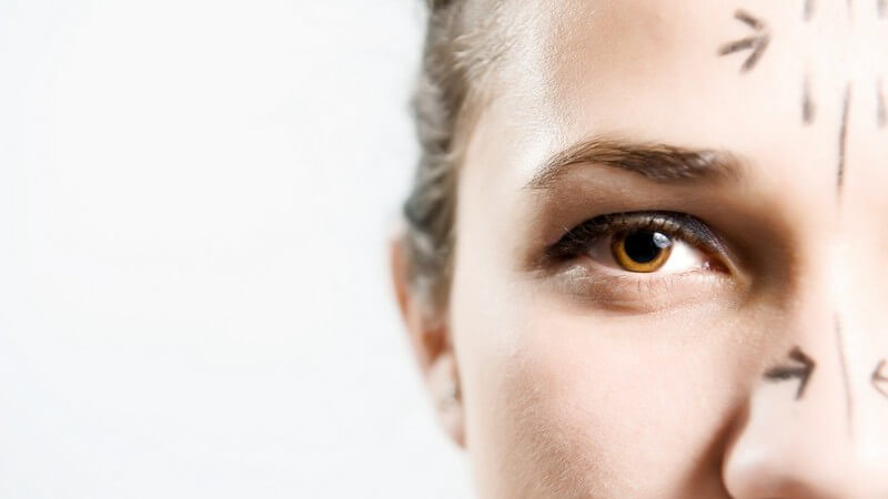 Nase und Stirn vor Schönheitsoperation mit Stift gekennzeichnet