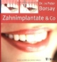 Zahnimplantate & Co