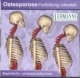 Osteoporose - Fortbildung interaktiv