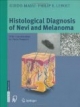 Histological Diagnosis of Nevi and Melanoma