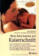 Mein Baby kommt per Kaiserschnitt